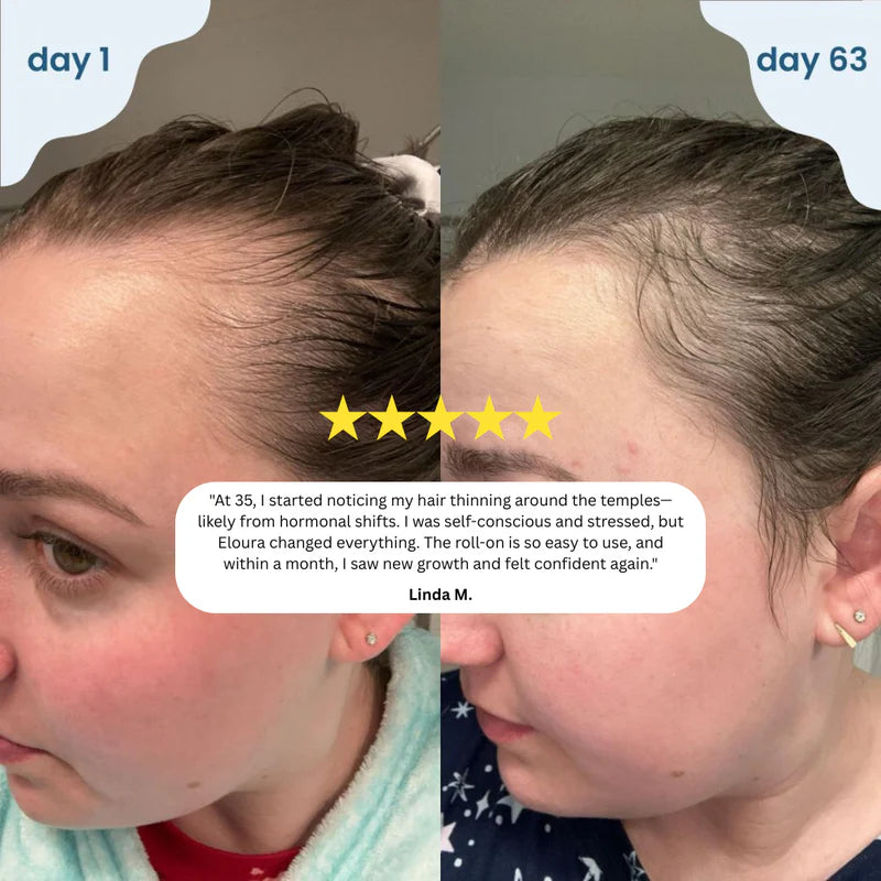 Novaira™ Advanced Hair Growth Roll On Serum