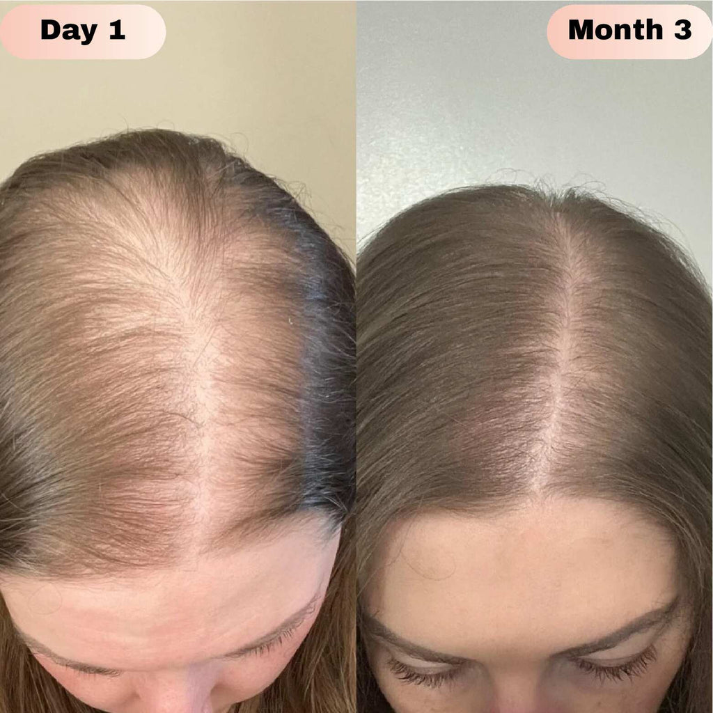 Novaira™ Advanced Hair Growth Roll On Serum