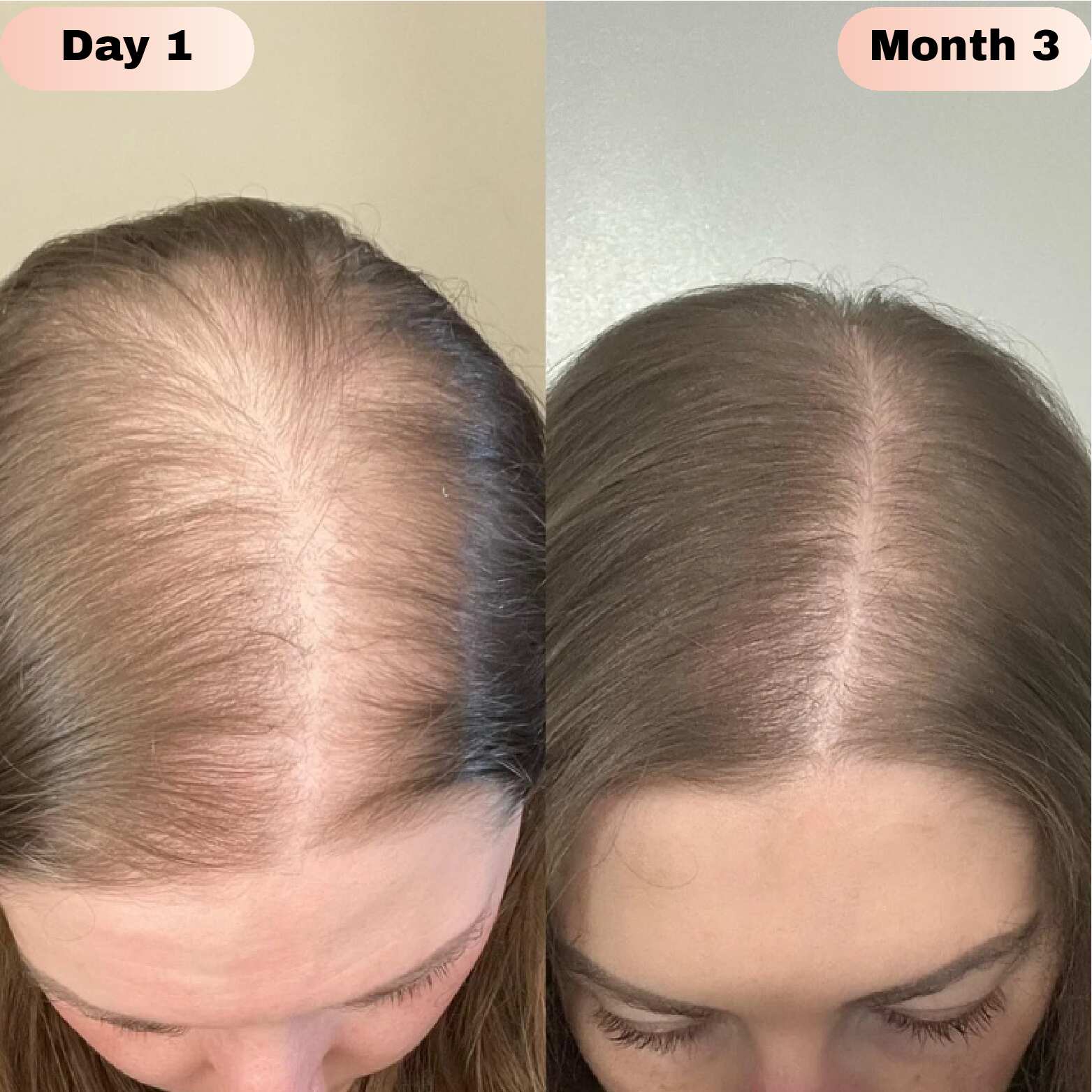 Novaira™ Advanced Hair Growth Roll On Serum