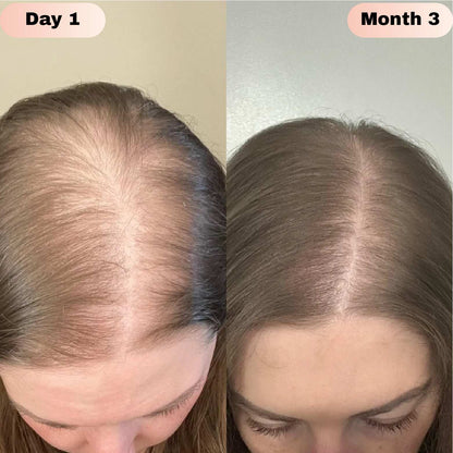 Novaira™ Advanced Hair Growth Roll On Serum