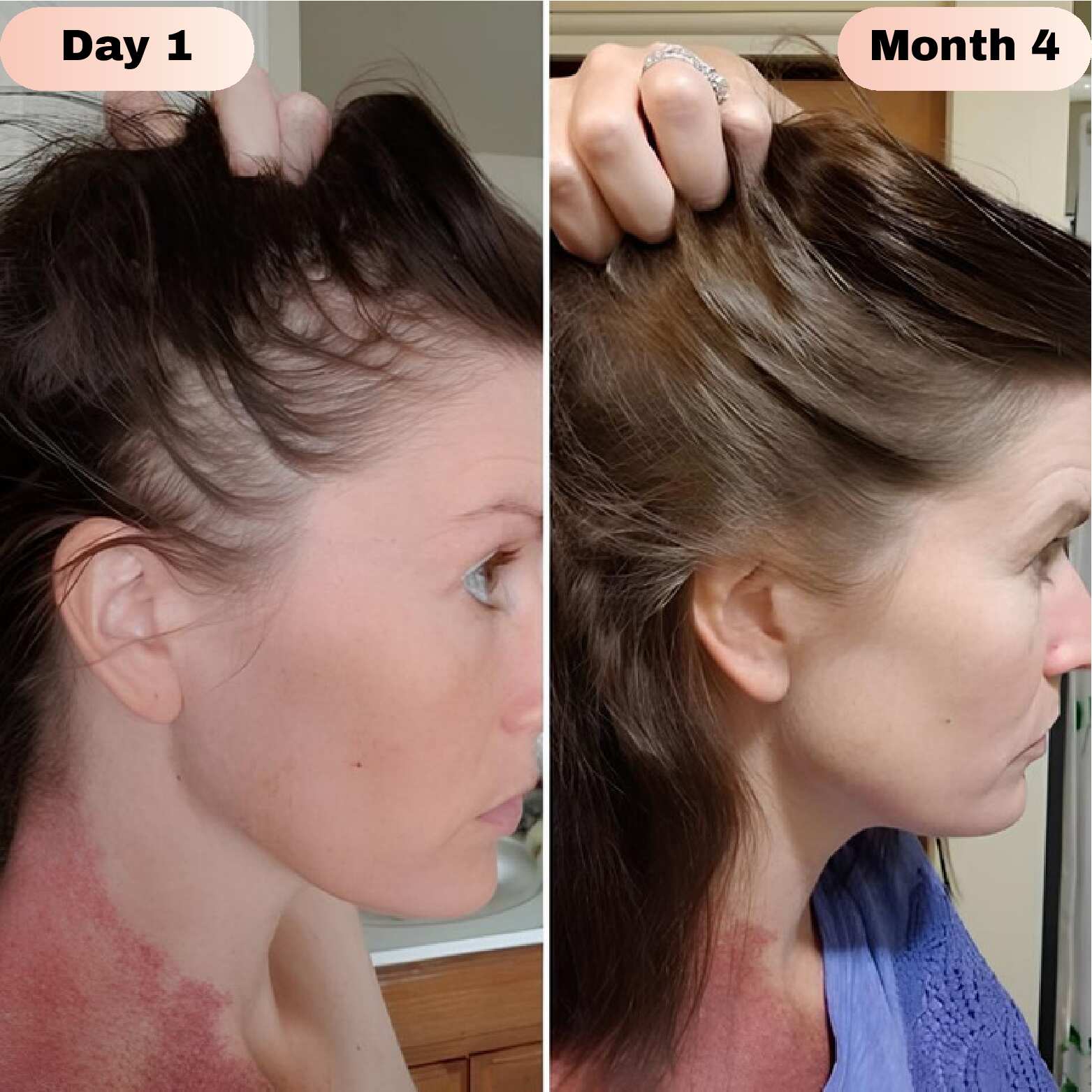 Novaira™ Advanced Hair Growth Roll On Serum