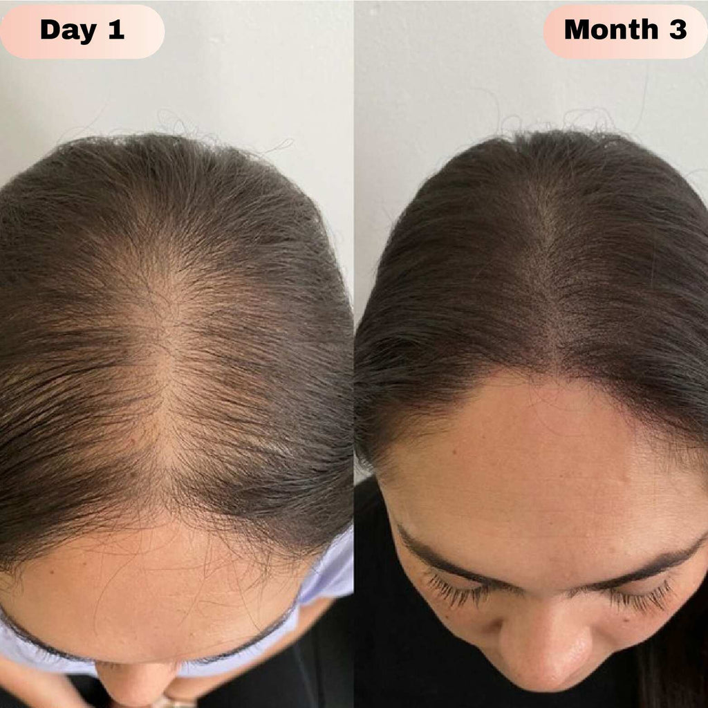 Novaira™ Advanced Hair Growth Roll On Serum