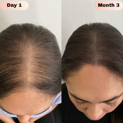 Novaira™ Advanced Hair Growth Roll On Serum